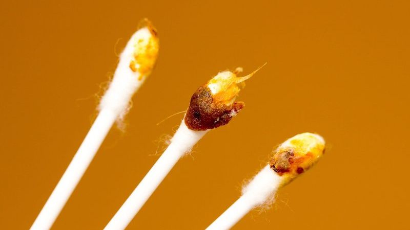 Loại bỏ ráy tai cho trẻ với dung dịch Otosan Natural Ear Drop 2