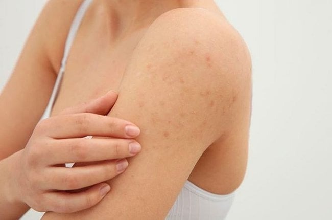 loi-ich-cua-bot-yen-mach-keo 2.jpg