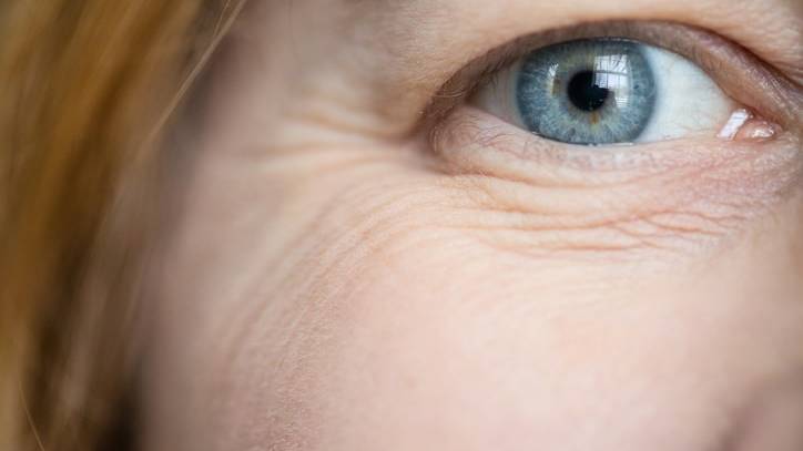 Da xỉn màu là gì? Nguyên nhân và cách khắc phục làn da xỉn màu 4