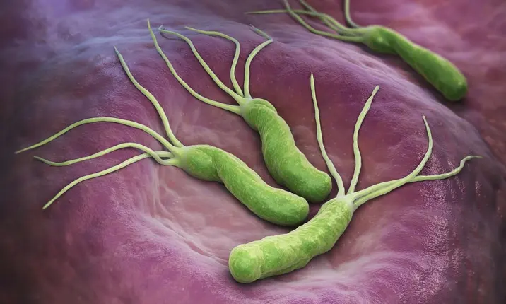 Nguyên nhân tiềm ẩn của ung thư dạ dày 3