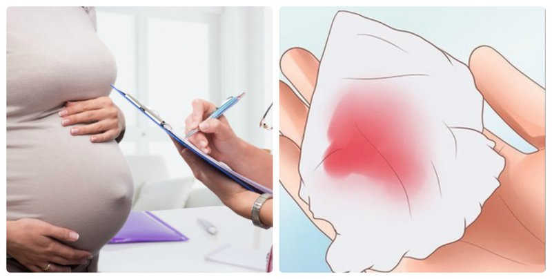 Những dấu hiệu nguy hiểm khi mang thai tháng cuối mà mẹ bầu cần lưu ý 2