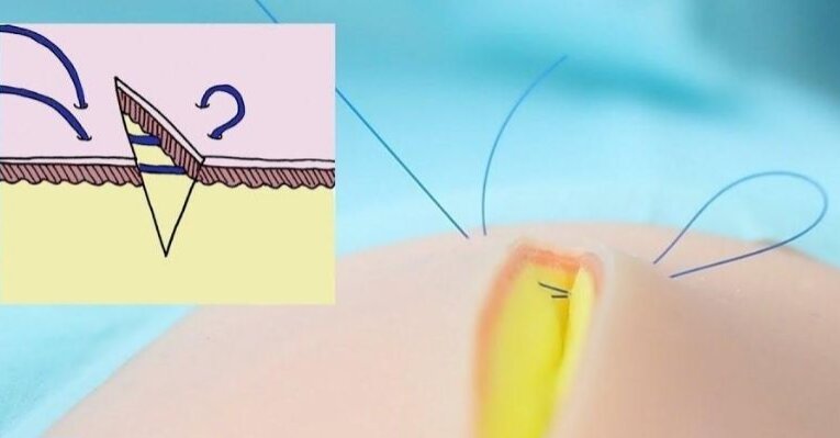 nhung-dieu-can-biet-ve-khau-vet-thuong 3.jpg