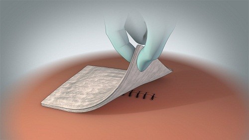 nhung-dieu-can-biet-ve-khau-vet-thuong 4.jpg