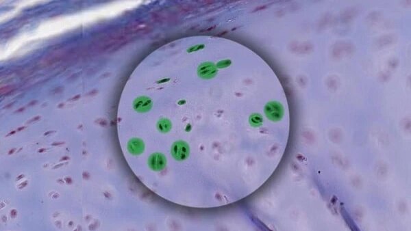 nhung-dieu-can-biet-ve-sun-va-nguyen-nhan-gay-ra-ton-thuong-sun-thuong-gap 3.jpg