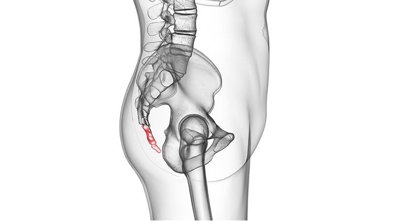Những khối u vùng xương cụt thường gặp và phương pháp điều trị 3