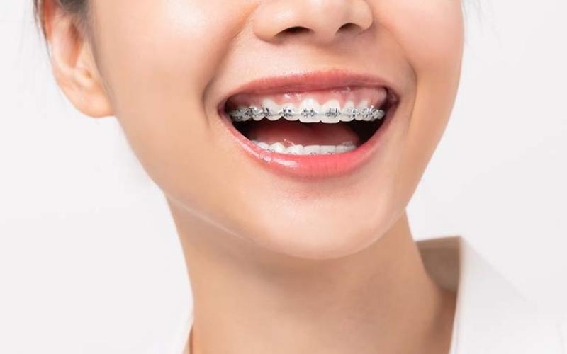 rang-lech-nhan-trung-la-gi-phuong-phap-dieu-tri-hieu-qua 1.jpg