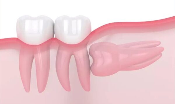 rang-nguoi-truong-thanh-co-bao-nhieu-cai 2.jpg