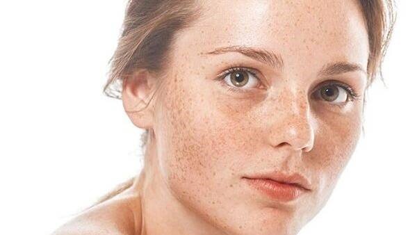 sac-to-da-la-gi-nhung-benh-ly-lien-quan-den-bat-thuong-sac-to-da 1.jpg