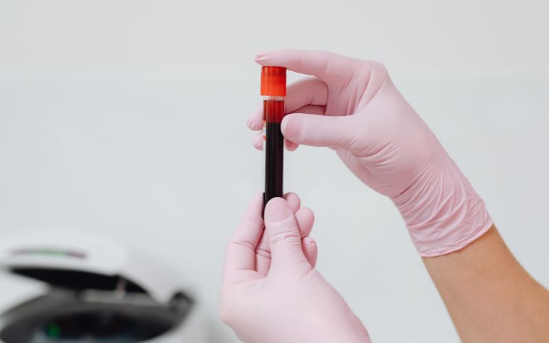 Các xét nghiệm sàng lọc trước sinh bao gồm: Double test, triple test, NIPT...