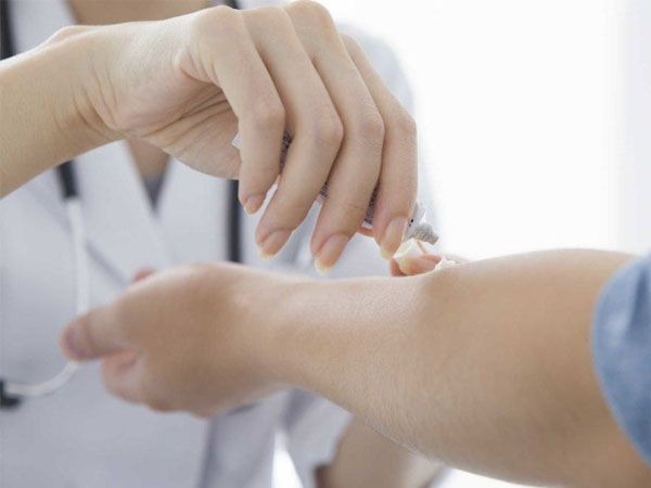 so-cuu-bi-bong-nen-lam-gi 4.jpg