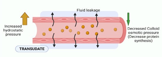 Dịch thấm và dịch tiết khác nhau như thế nào? Cách chẩn đoán phân biệt 1