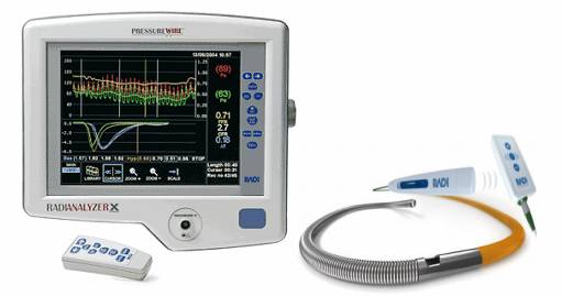 Tầm quan trọng của phân suất dự trữ lưu lượng động mạch vành (FFR) trong việc chẩn đoán và điều trị bệnh lý mạch vành 2