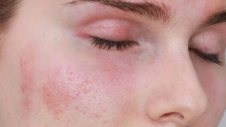 test-ap-bi-la-gi-dung-trong-truong-hop-nao 1.jpg