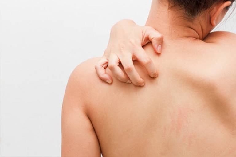 Thuốc auclanityl 875/125mg trị bệnh gì? Cách dùng thuốc auclanityl như thế nào? 2