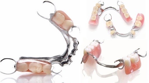 tim-hieu-ve-ham-khung-thao-lap-kim-loai-va-nhung-dieu-can-luu-y 4