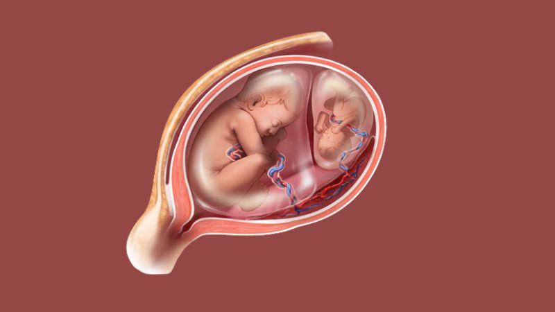 Tìm hiểu về tình trạng 1 túi thai có 2 phôi thai 1