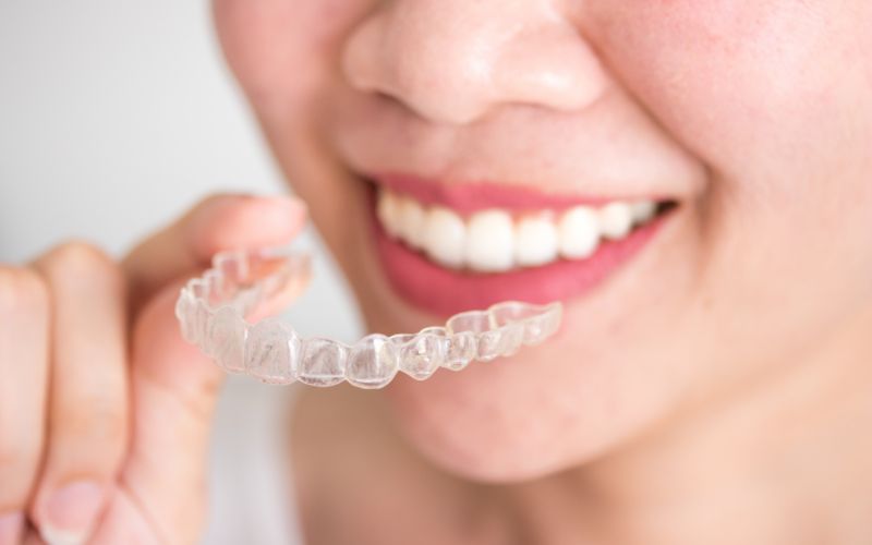 Trẻ 15 tuổi niềng răng bao nhiêu tiền? Niềng răng trong bao lâu? 3