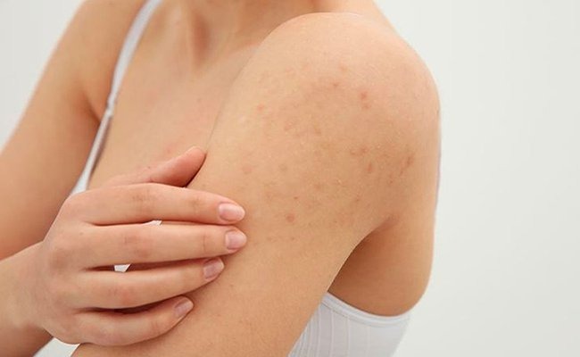 triet-long-co-thu-nho-lo-chan-long-khong 2.jpg