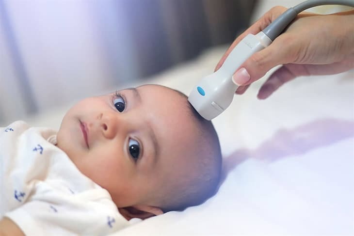 Xét nghiệm máu có biết viêm màng não hay không? 3