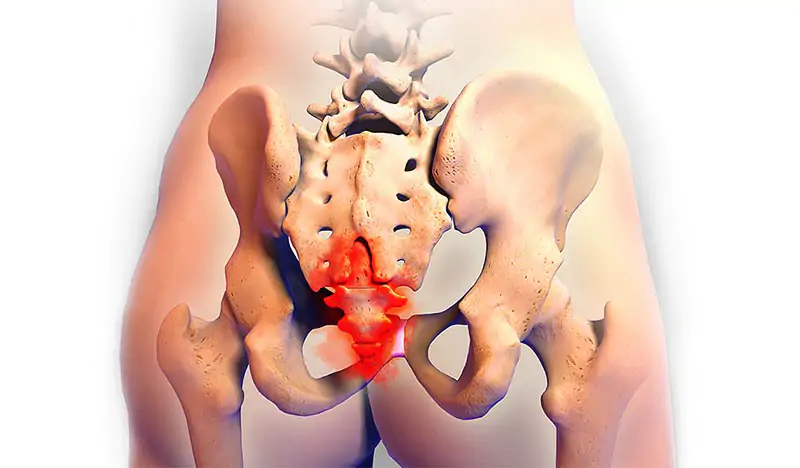 Xương cụt nằm ở đâu và có vai trò gì? Thông tin về bệnh lý tại xương cụt 2