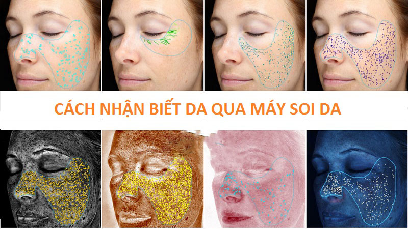 Soi da là gì? Cách nhận biết da qua máy soi da 2