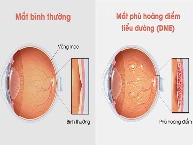Soi đáy mắt được sử dụng để làm gì? 3