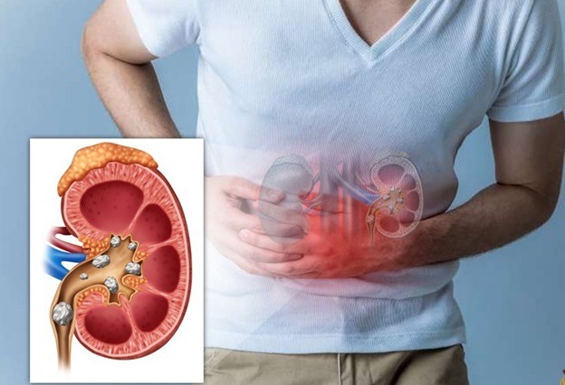 soi-than-nen-kieng-an-gi-de-tranh-lam-benh-tro-nen-nghiem-trong-hon 1.jpg