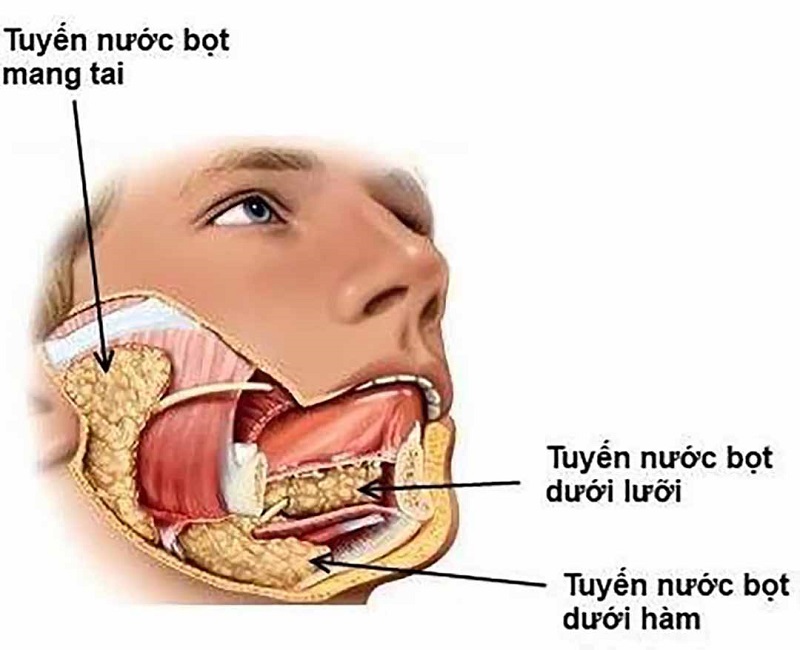 Sỏi tuyến nước bọt: Những thông tin quan trọng bạn cần biết 1