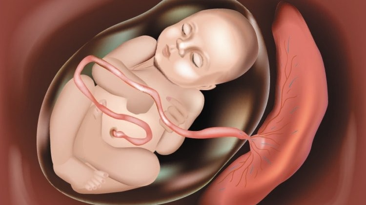 Sót nhau sau sinh: Nguyên nhân, triệu chứng, điều trị và cách phòng ngừa 1