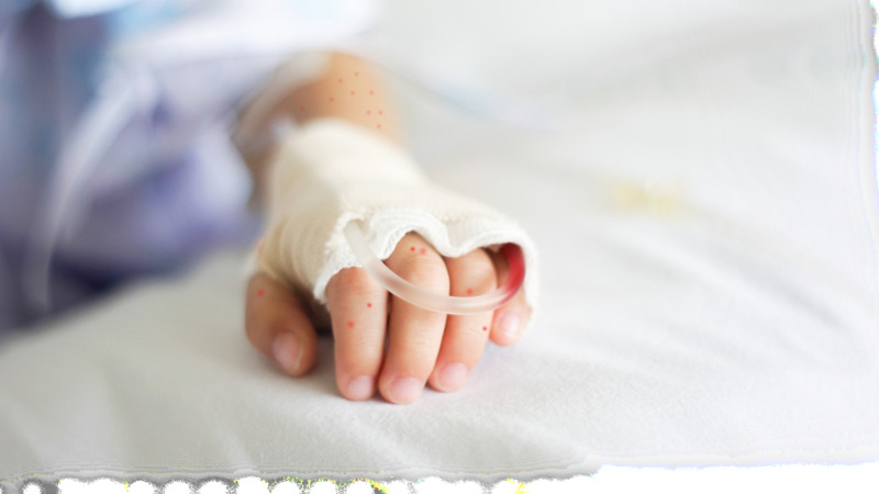 sot-xuat-huyet-co-can-nhap-vien-khong-cac-bien-chung-neu-khong-nhap-vien-kip-thoi 1.jpg