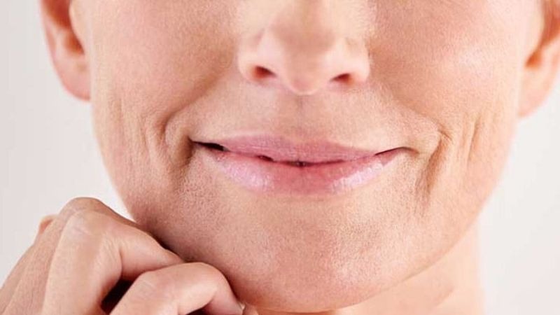 Sự hình thành nếp nhăn khóe miệng do đâu?