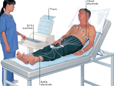 Suy tim là gì? Khám bệnh nhân suy tim gồm những gì? 3