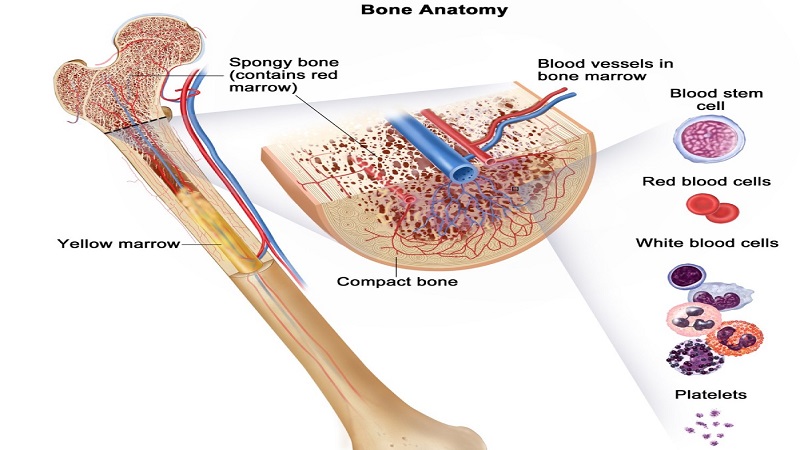 Suy tủy xương sống được bao lâu? Có chữa được không? 1