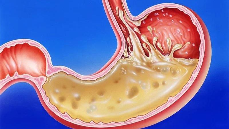 Tác dụng của nhóm PPI trong điều trị bệnh 1