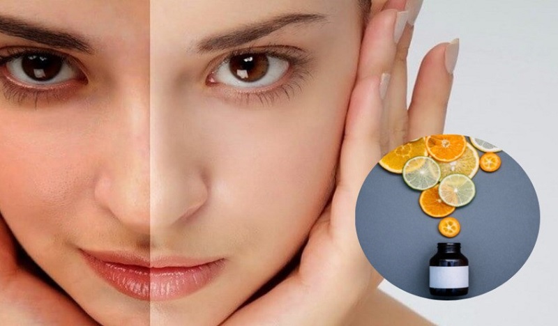 Tác dụng của vitamin C với da có thể bạn chưa biết 3