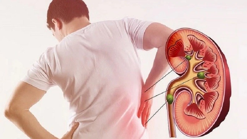 Tại sao đái tháo đường gây suy thận? Biến chứng trên thận có nguy hiểm không? 2