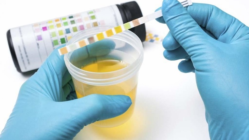 Tại sao đái tháo đường gây suy thận? Biến chứng trên thận có nguy hiểm không? 3