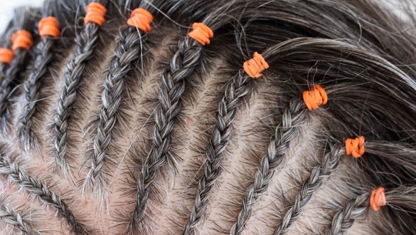 tai-sao-goi-dau-xong-van-ngua-cach-khac-phuc-hieu-qua 2