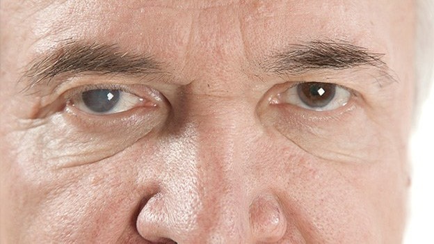 tang-nhan-ap-la-gi-chia-khoa-bao-ve-suc-khoe-doi-mat