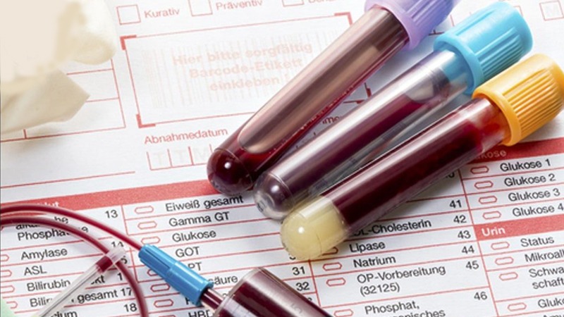 Tăng phospho máu là gì? Cách điều trị và phòng ngừa 1