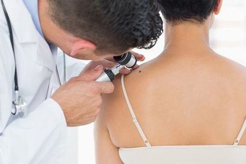 tay-not-ruoi-co-an-duoc-mi-tom-khong-nhung-thu-can-kieng-sau-khi-tay-not-ruoi 5