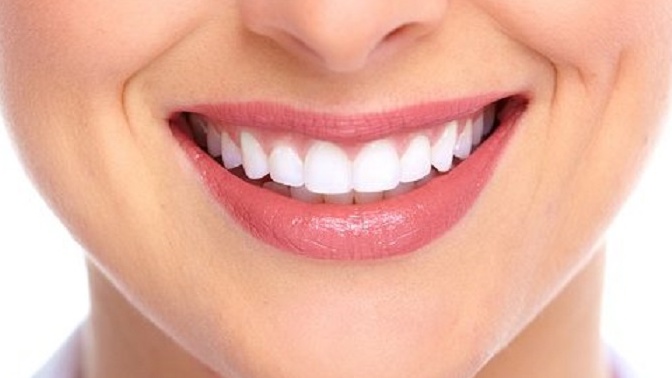 Tẩy trắng răng mất bao lâu thì đạt hiệu quả 1