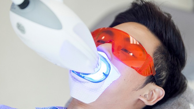 Tẩy trắng răng mất bao lâu thì đạt hiệu quả 3