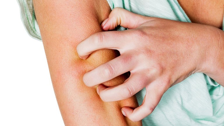 Thắc mắc: Bà bầu bị zona thần kinh kiêng gì nhanh khỏi? 4