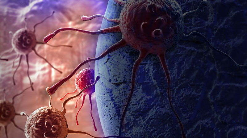 Thắc mắc: Tế bào ung thư thích ăn gì nhất? 1