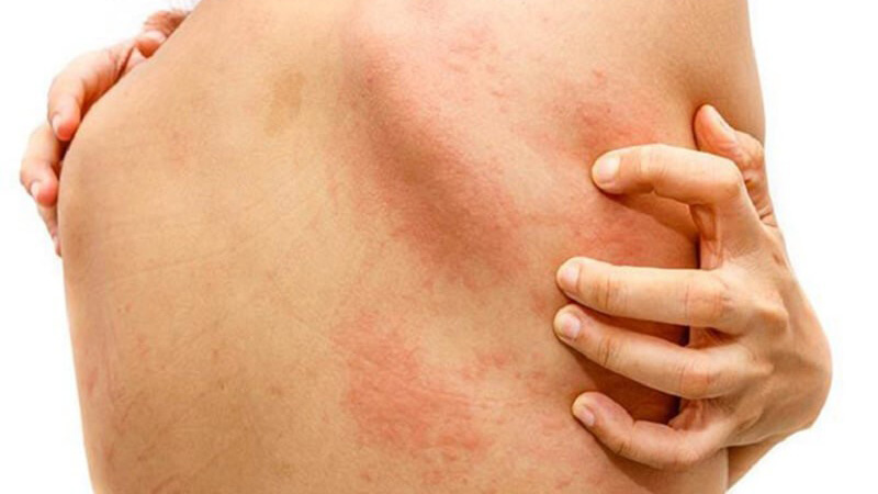 Thắc mắc: Uống thuốc dị ứng bao lâu thì có tác dụng 1