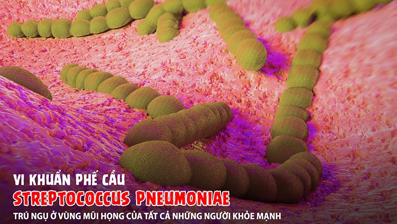Thắc mắc: Viêm phổi do phế cầu là gì? Có nguy hiểm không? 5