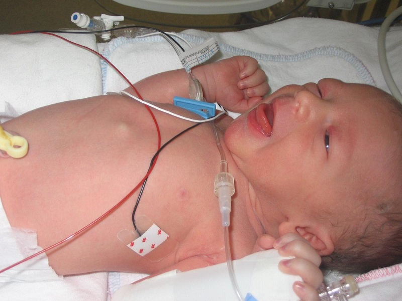 Thai IVF là gì? Tại sao thai IVF hay sinh non? 4