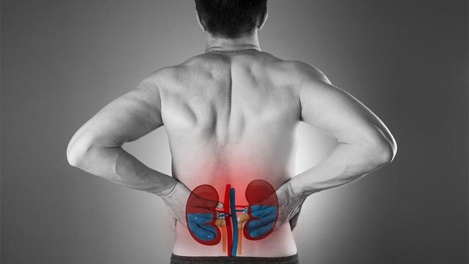 Thận ứ nước độ 1: Nguyên nhân và cách điều trị 1