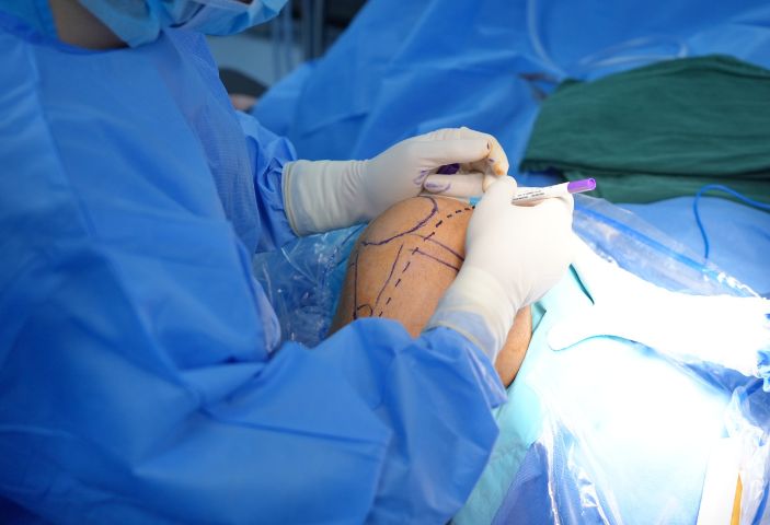 thay-khop-goi-o-benh-vien-nao-tot-nhat 2.jpg